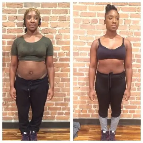 A woman's before and after weight loss photos